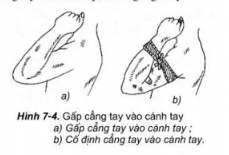 Lý thuyết GDQP 10 Kết nối tri thức Bài 12: Kĩ thuật cấp cứu và chuyển thương